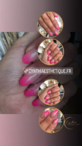 Faux ongles en résine avec babycolor